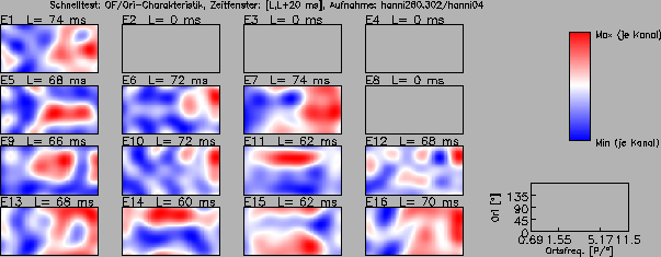 \includegraphics[width=14 cm]{grafiken/tuningplots/QTun_sgl_020326}