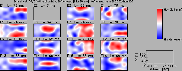 \includegraphics[width=14 cm]{grafiken/tuningplots/QTun_sgl_020329}